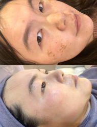 -韩美绣·骨相纹眉·洗眉美瞳线