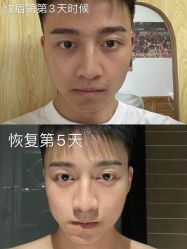 点击看大图 -OnFaer.纹眉半永久无创洗眉