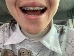 -深圳佑诺口腔门诊部