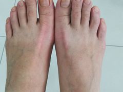 -世龙世家甲沟炎·灰指甲·嵌甲矫正·修脚(武侯区双楠店)