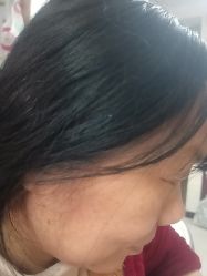 -长沙雅美医疗美容医院
