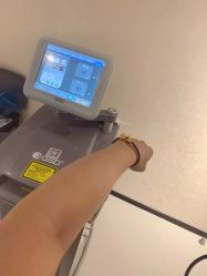 点击看大图 体验后-广东韩妃整形外科医院