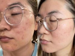 -中科妍美专业脱毛美肤连锁机构