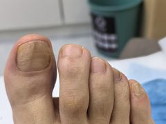 -郑远元专业修脚房(宣化路店)