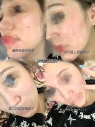 -慕颜医疗美容·皮肤微整 抗衰