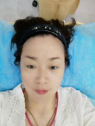 体验前-鑫元辰医疗美容整形