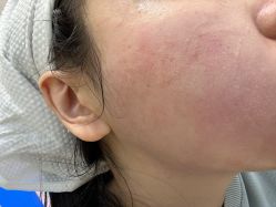 -张小熊连锁轻医美