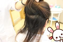 点击看大图 -大麦微针植发丨全国连锁