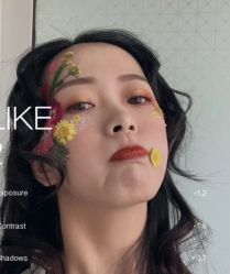 -大麦微针植发全国连锁