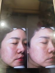 -苑苑vbeauty科技美容SPA