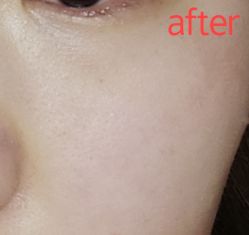 -万州华美紫馨整形美容医院