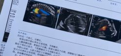 -米诺娃妇女儿童医院·三级妇儿医院