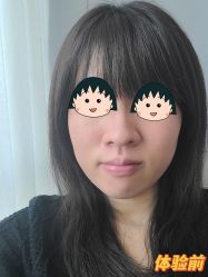-伊丽莎白医疗美容