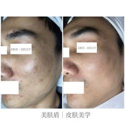 -美肤盾祛痘·问题肌头疗管理中心