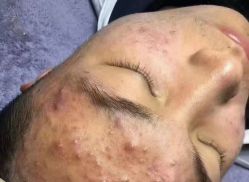 点击看大图 -玫莉蔻皮肤管理中心