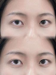 点击看大图 -张小野·专业半永久纹眉