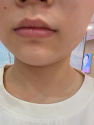 -长沙雅美医疗美容医院