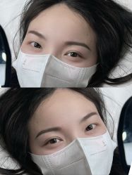 点击看大图 -张小野·专业半永久纹眉