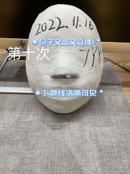 -小颜秘家·韩国整骨