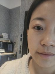 体验后-爱小熊轻医美