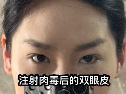 -上海玫瑰医疗美容医院