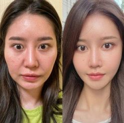 -Yestar 嘉兴艺星医疗美容医院