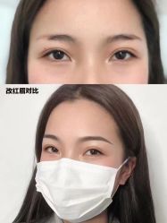 -莲姿娜·半永久纹眉皮肤管理
