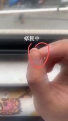 -德哥灰指甲脚气甲沟炎跖疣护理