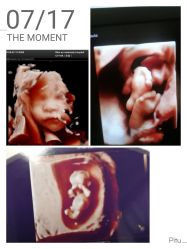 -郑州万安妇产医院