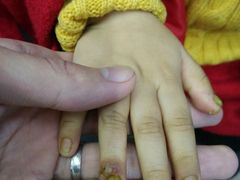 -Andrew指甲专科灰指甲·甲沟炎矫正·3D步态矫形鞋垫定制(上海法华镇路旗舰店)
