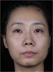 体验前-联合丽格·张菡丽格医疗美容