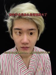 -北京米扬丽格医疗美容·联合丽格鼻整形中心