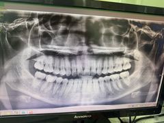 -宁波儿童口腔医院(钱湖院区)