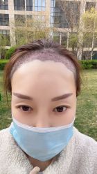 -熙朵美学植发连锁