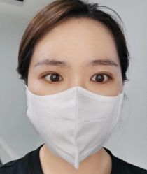 体验后-金圣医疗美容