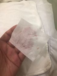 -塑青春&伊肤泉祛痘皮肤管理