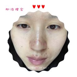 -净颜专业祛斑祛痘