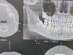 -深圳富茂格伦菲尔口腔门诊部(龙华清湖总院)