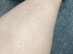 -美莱医学美容医院