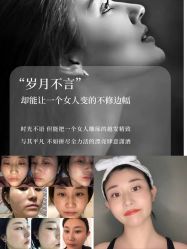 -黎蓓露·徒手骨雕蛋白抗衰·调肤管理