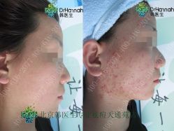 点击看大图 -瓷肌博士·祛痘科技美肤