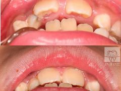 -Dr.Z dental仁康种植矫正中心