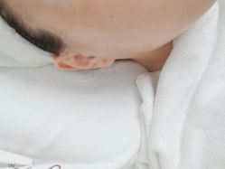 体验后-JS医疗美容