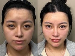 -上海伊莱美医疗美容医院