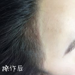 -西施无菌半永久纹绣眉眼影唇轻增发纹发际线