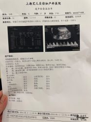 -上海艾儿贝佳妇产科医院