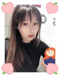 -大麦微针植发全国连锁