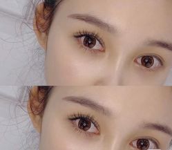 -Younger Skin·科技氧肤中心