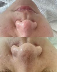 -王妃SPA·美容·科技抗衰