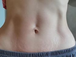 -Lily纤美·科技减脂中心